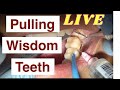 Amazing Wisdom tooth Removal LIVE DEMO-अकल दाढ़ को निकलने की LIVE प्रक्रिया -Dr.Praveen Bhatia