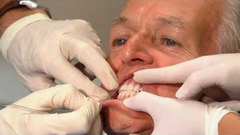 Denture Bootcamp Part IX: Finalization