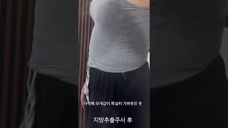 #지방추출주사#복부지방추출주사#지방분해주사#다이어트#여름다이어트#복부다이어트#복부비만#비만탈출#분해주사#직장인다이어트#지방분해#다이어트방법#지방분해주사효과#지방분해주사전후