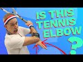 Do I have tennis elbow? Learn how to tell TODAY #elbowpain#tenniselbow#lateralepicondylitis