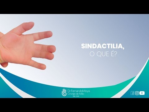 Vídeo: Sindactilia - Classificação, Causas, Tratamento