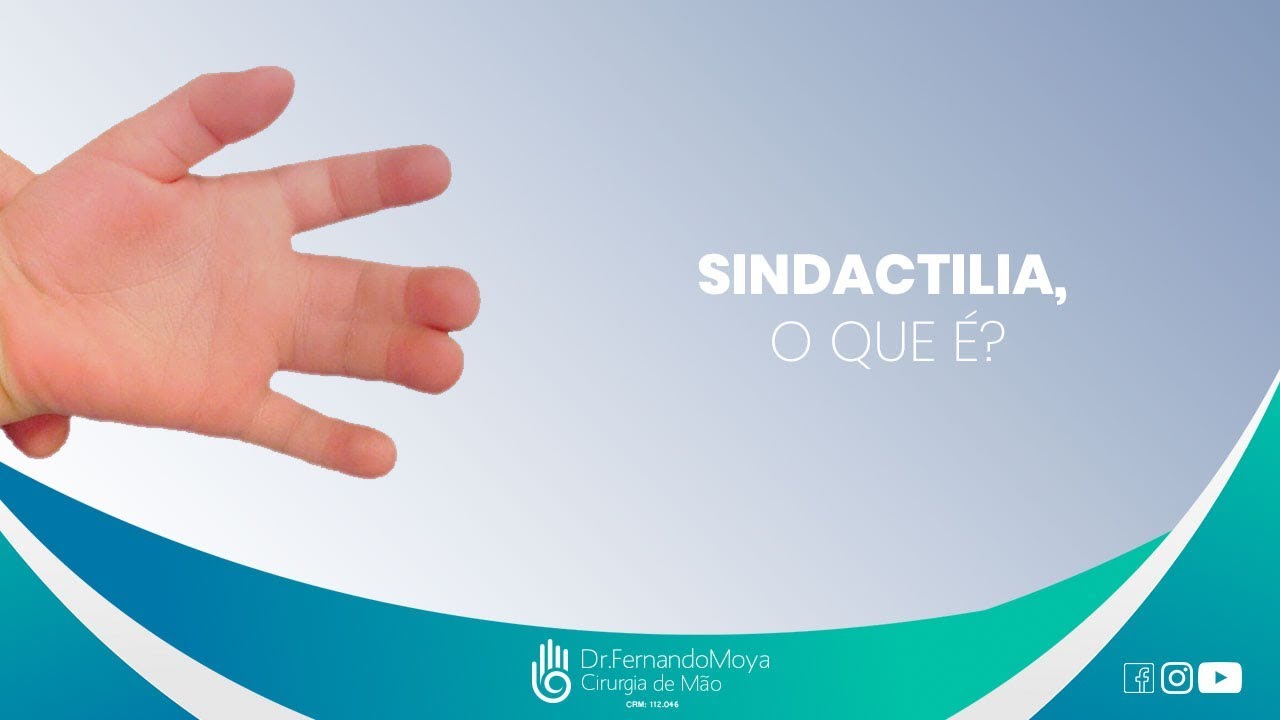 Quando Os Dedos Nascem Grudados?