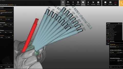Zirkonzahn Modellier Angled Screw Channel ~~轉載自High dental Korea~~