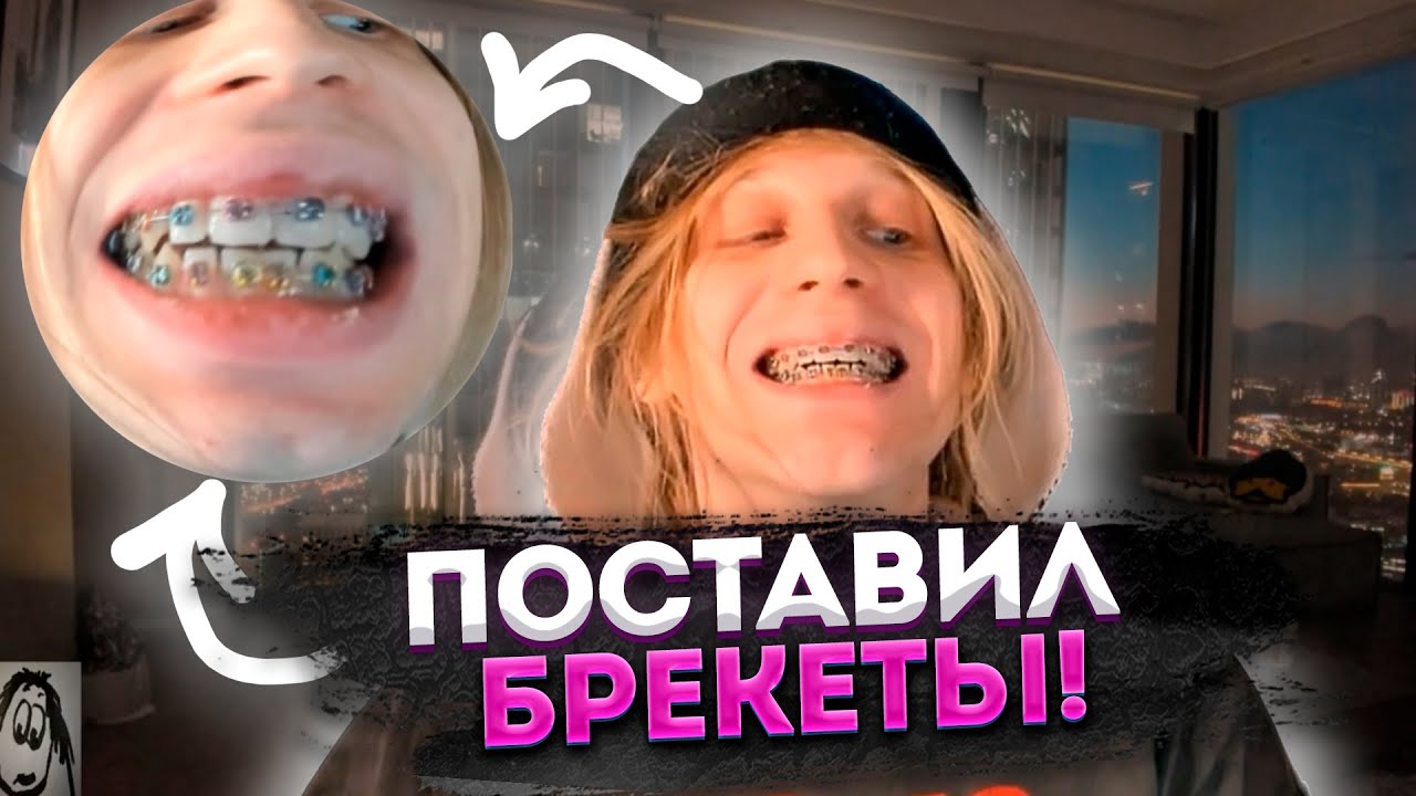 КОСТЯ ПЛОХОЙ ПАРЕНЬ ПОСТАВИЛ БРЕКЕТЫ! I ХАЗЯЕВА - YouTube