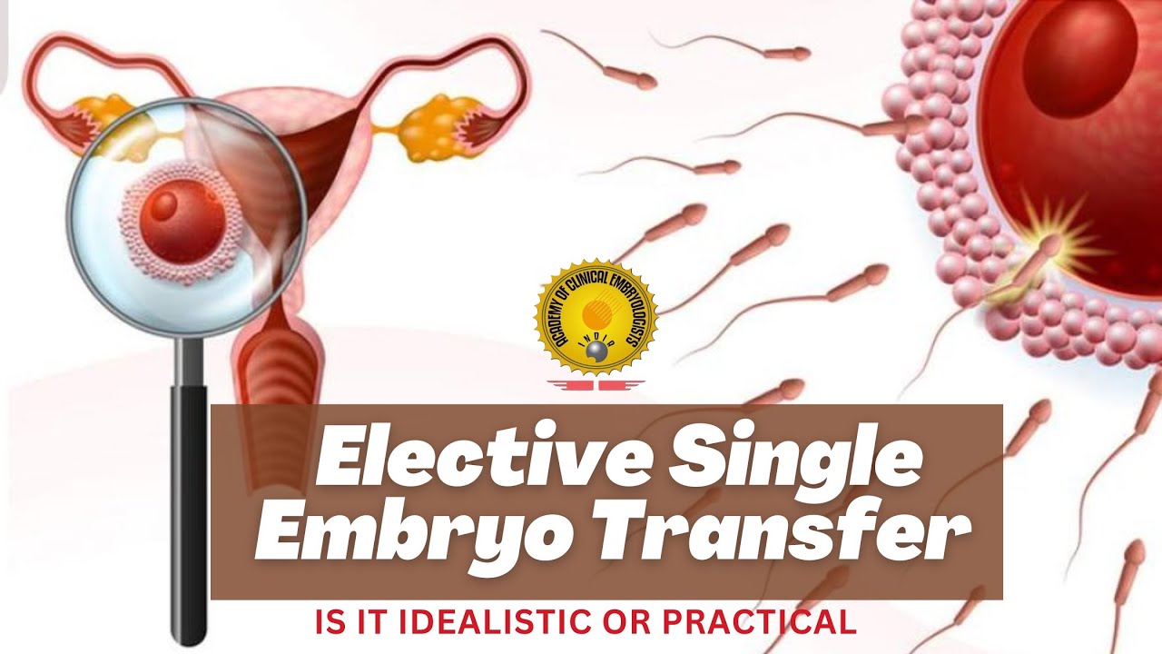 Elective Single Embryo Transfer — Is it Idealistic or Practical? | ACE India