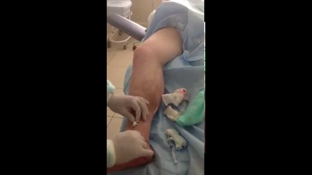 Какие питательные вещества поступают в печень по воротной вене