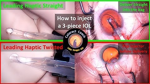 How to properly load and inject a three-piece acrylic IOL during cataract surgery