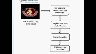 Lung Cancer Detection  MATLAB Image Processing