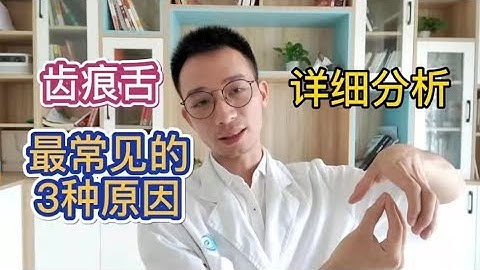 人未老，脾先衰！舌头有齿痕还胖大，脾虚痰湿重！祛湿先治脾虚！教你3招健脾胃祛痰湿！古代名医调理脾虚好方子，1周养出好脾胃！长寿的人一定脾胃好！ - 天天要闻