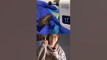 A Frog Just Got an Eye Pressure Test