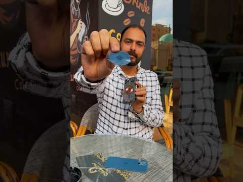تدخل الليزر في تغير ضهر  12  طبيب المحمول