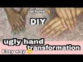 Ugly Hand Transformation Easy home remedy with natural ingredients ||DIY||Neha Das