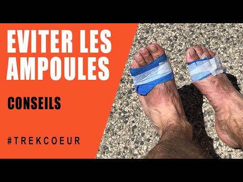 Eviter les ampoules en randonnée 