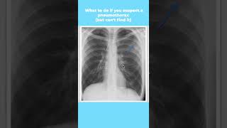 What to do if you suspect a pneumothorax (but cant find it) #shorts
π Find out more about diagnosing pneumothorax in our course: https://bit.ly/4dKY7Bu
π Unlock More with Your Trial Access: https://bit.ly/3ywnJlb What to do if you suspect a pneumothorax (but cant find it) #shorts