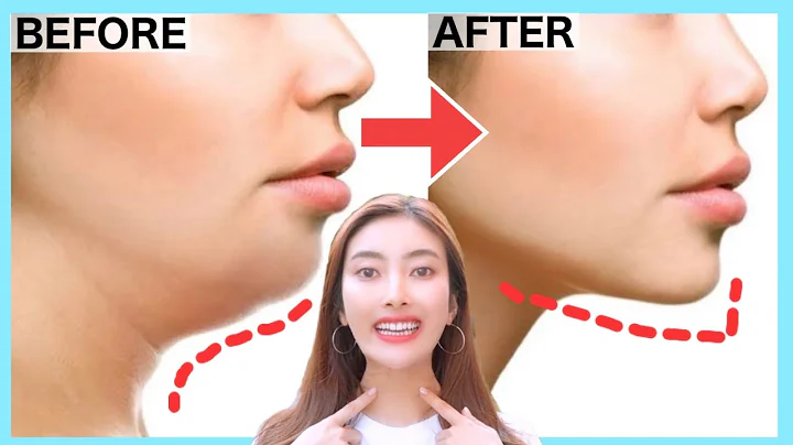 Double Chin Removal and Wrinkles, Get a Better Jaw...