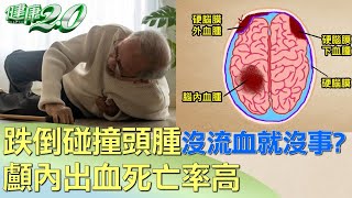 跌倒碰撞頭腫沒流血就沒事顱內出血死亡率高 健康2.0