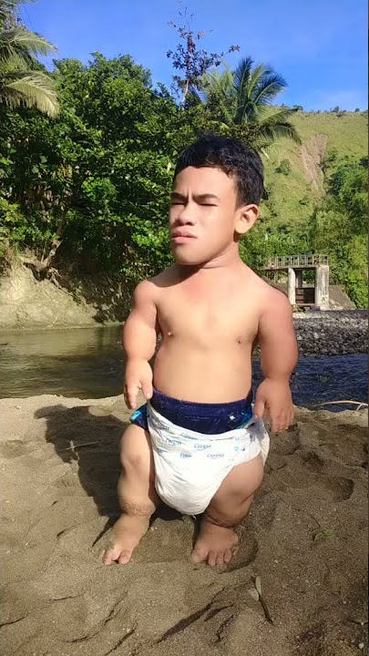 video org kerdil viral tik tok