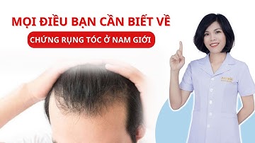 MỌI ĐIỀU BẠN CẦN BIẾT VỀ CHỨNG RỤNG TÓC NAM | DS.HOÀI