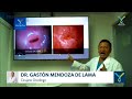 Explicación de Cáncer de Cuello Uterino con el Dr. Gastón Mendoza De Lama