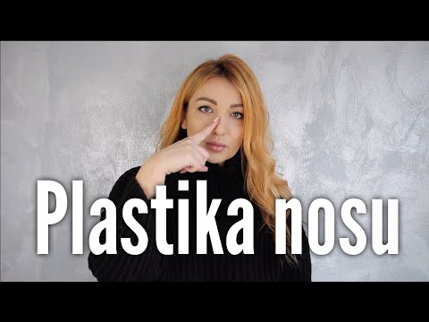 Video: Rinoplastika, Botox A Dýhy: Nevěsta Ivlevy Upřímně řekla, že Se V Sobě Zlepšila