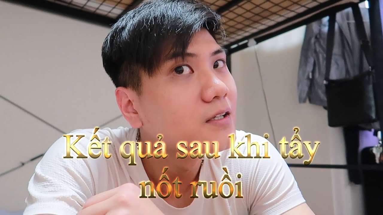 tẩy nốt ruồi an toàn Update New Kết quả Sau khi tẩy nốt ruồi bằng thuốc tẩy nốt ruồi - Giang NBG