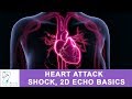 Understanding Acute Coronary Syndrome and Related Concepts