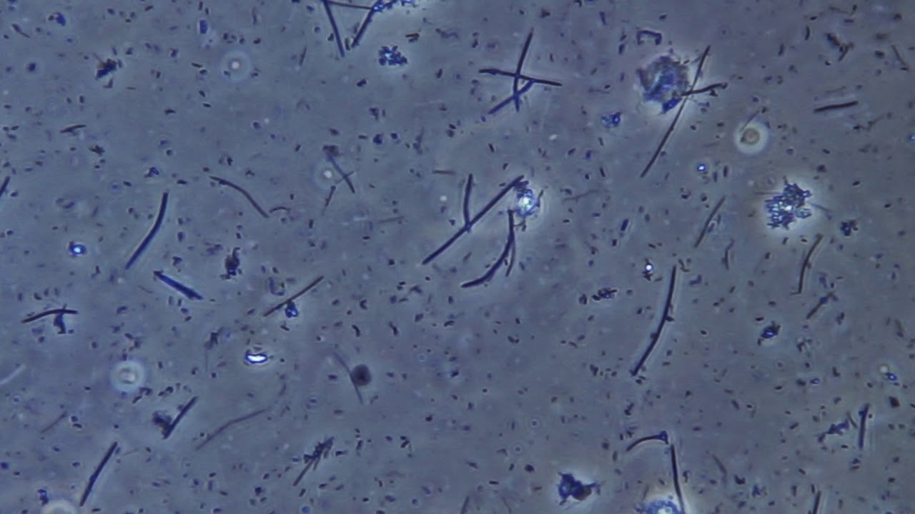 Бактерии в слюне. Микрофлора зубного налета под микроскопом. Бактерии на зубном налете микроскоп. Бактерии зубного налета под микроскопом. Бактерии ротовой полости под микроскопом.