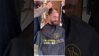 Chris Bumstead Hair Transplant