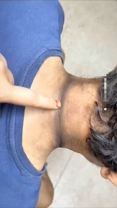 Neck Cleaning Tips | Dark Neck Remove Home Remedy | Remove Neck Tanning #neck #suntan #dark #shorts