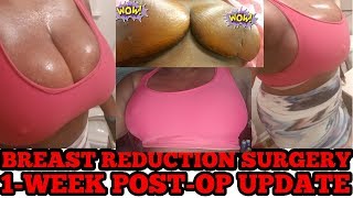 Breast Reduction Surgery: 1 Week Post-OP Update 