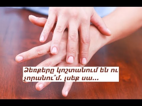 Video: Վերքերը թաքցնելու 5 եղանակ