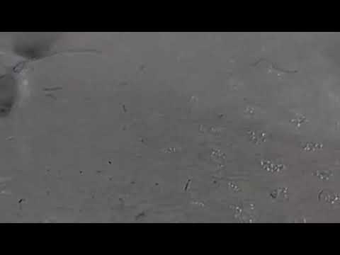 Video: Močový Měchýř červ U Potkanů