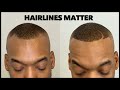 Hairlines Matter