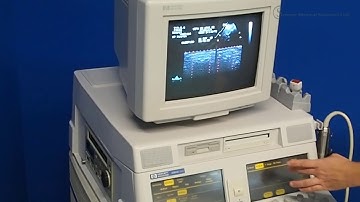 HP Ultrasound Sonos 5500 with 3 Probes (18509)