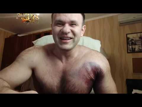 Порванная мышца бодибилдинг