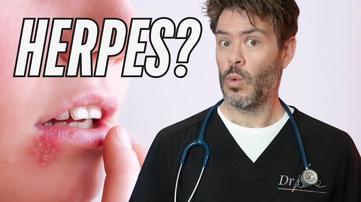 Why Is Everyone So Scared of Herpes? (And Why You Don't Need to Be!)