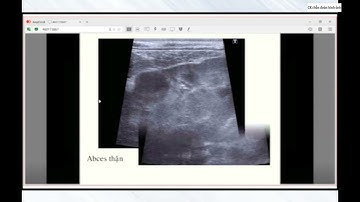 Tiếp cận siêu âm đau bụng cấp trong nhi khoa | Part 2/3 - BS. Nguyễn Hữu Chí