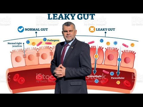 191 علاج ارتشاح الأمعاء بطريقة بسيطة جد ا ارتشاح الامعاء