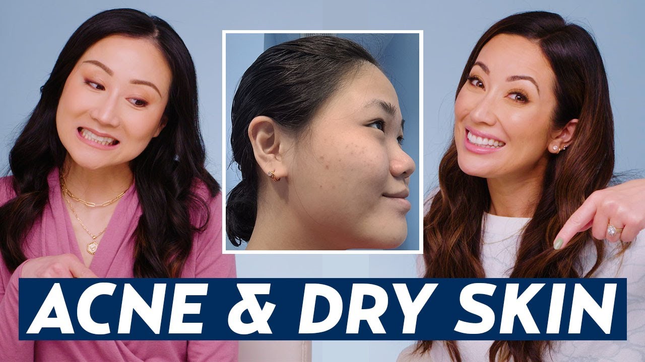 best-skincare-routine-for-acne-dry-skin-dermatologist-advice-for