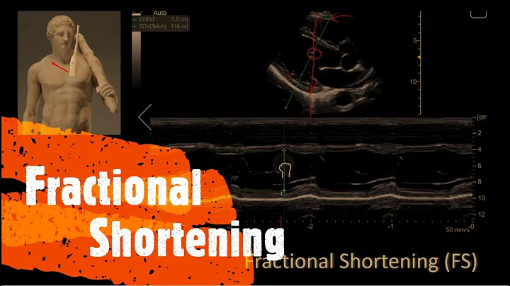 Fractional Shortening. Perioperative & Critical Care ECHO / POCUS