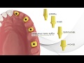 Супраструктуры BioLine by Bio3 Implants