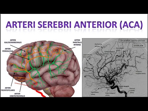 Video 37 Arteri Serebri Anterior (Anterior Cerebral Artery (ACA))