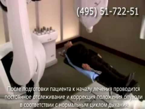 Кибер-Нож - лечение опухолей позвоночника