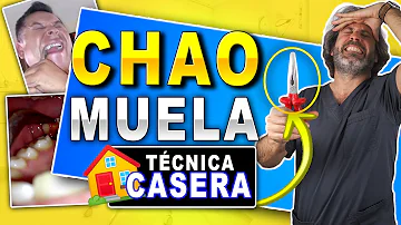 ¿Puedo quitarme los dientes de leche en casa?