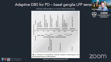18. Movement Disorders Surgery: Research and Innovation by Dr. Mark Richardson