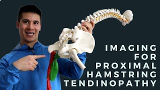 Imaging for Proximal Hamstring Tendinopathy