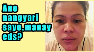 MUNTIK NAHIMATAY DAHIL SA KAGAT NG LANGGAM/MALOUS VLOG