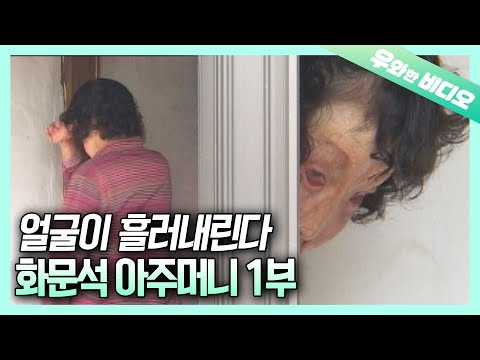 1부 흘러내린 얼굴 문밖으로 나갈 수 없는 여인의 잃어버린 55년 Ep 1 The Woman With Melted Face Can T Go Out The Door 