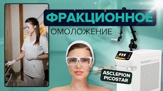 Фракционное лазерное омоложение. ПОДТЯЖКА ЛИЦА на PICO STAR