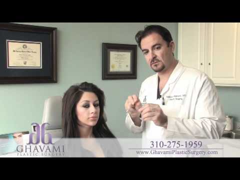 Video thumbnail: Custom Ethnic (hispanic) Rhinoplasty By Dr. Ghavami